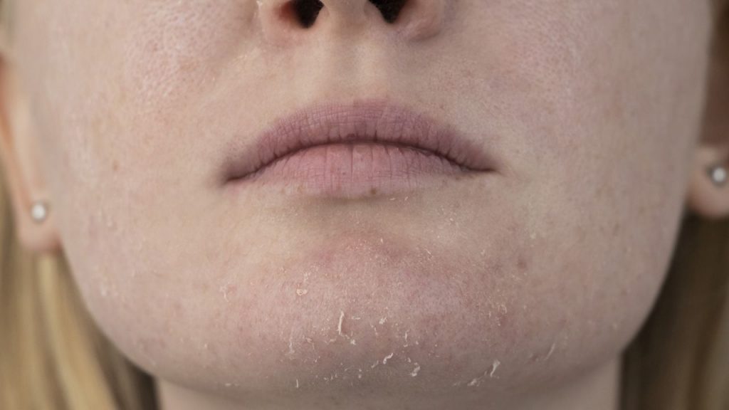 Estrés y dieta poco saludable