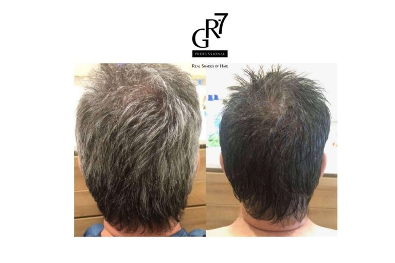 ¿Qué es GR-7 Professional?, el tratamiento anticanas que restaura el tono natural