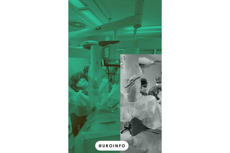 La cirugía robótica como alternativa para el tratamiento del cáncer de próstata, por Uroinfo