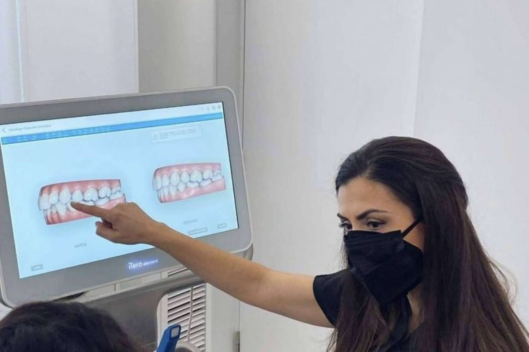 Ventajas ofrecidas por el tratamiento Invisalign, por Clínica dental Carmen Díaz