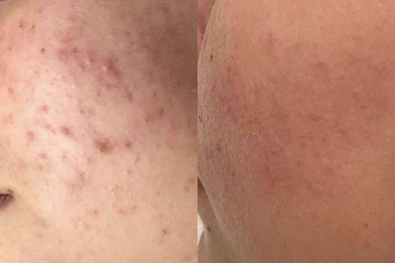 La importancia de de la piel y de usar los productos adecuados, por Le Meilleur de Toi