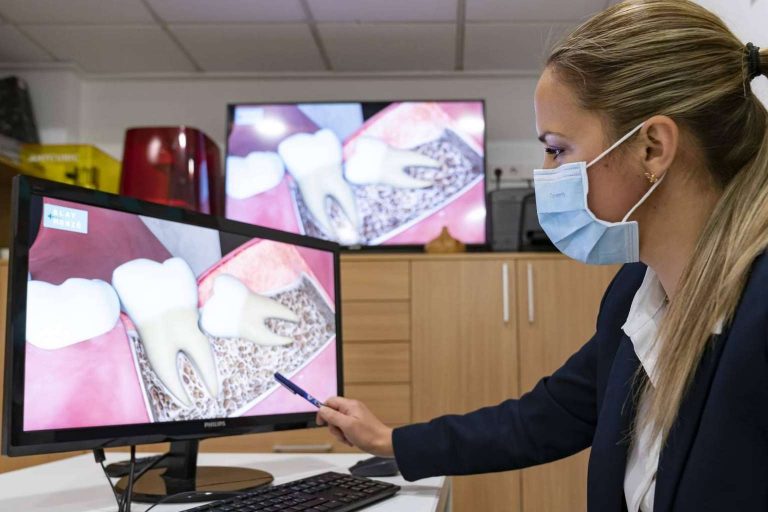 Cuáles son las verdades y los mitos sobre las muelas del juicio