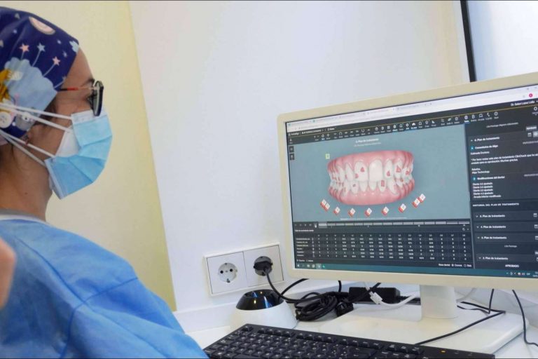 La ortodoncia invisible en Castellón de la mano de la Clínica Blay + Monzó