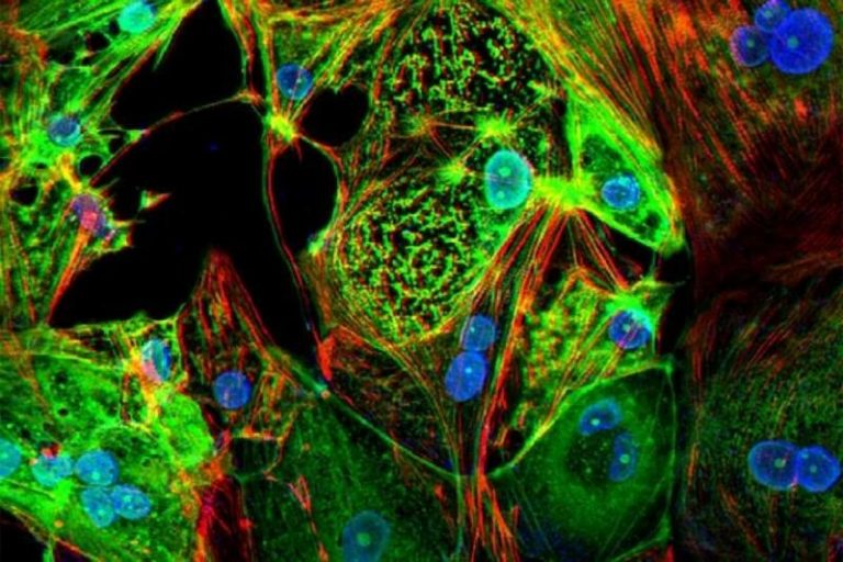 Un estudio confirma que las células T siguen reconociendo a la variante ómicron