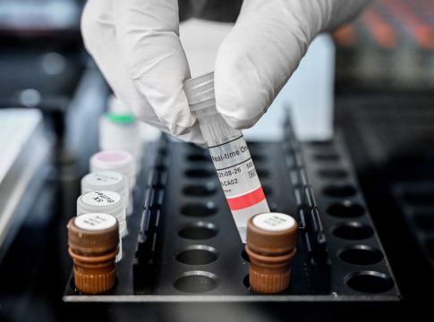 Canarias eleva a 15 las muertes en el último día y registra 2.327 nuevos positivos