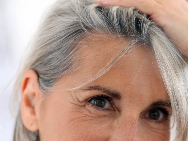 Este es el medicamento que previene las canas
