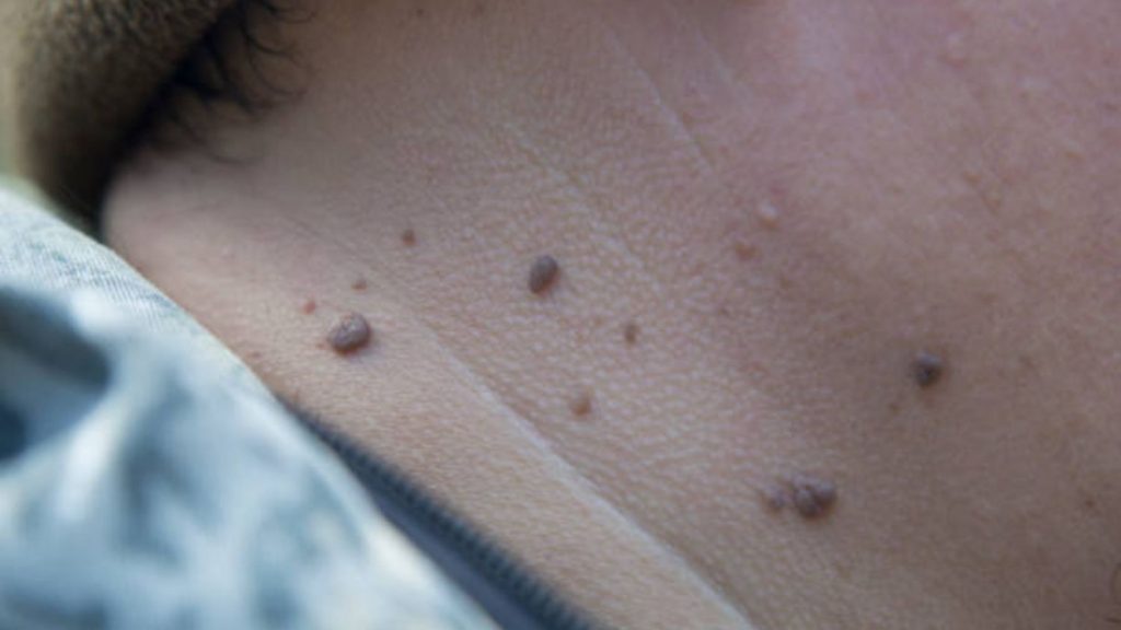 Tratamientos sin investigación completada