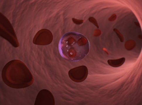 Identificado un nuevo mecanismo de migración celular utilizado por las células de leucemia