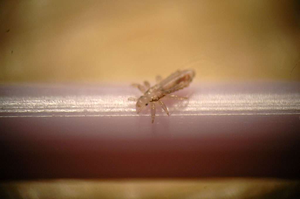 Cómo eliminar los piojos