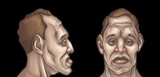 ¿Cuál es el tratamiento?