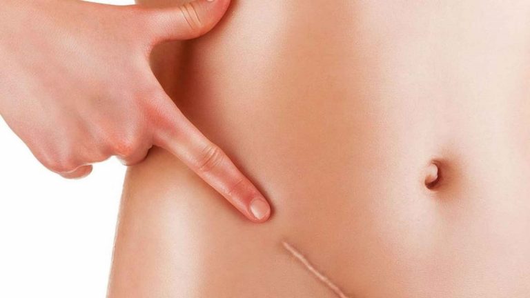 Del apéndice al bazo: los órganos que no sirven para nada en tu cuerpo