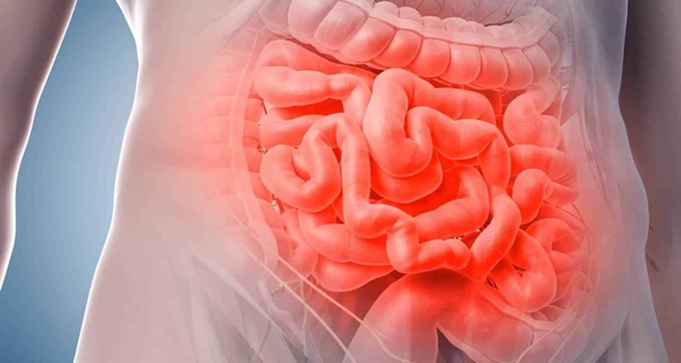 Tasas curación altas cáncer de colon alimentación