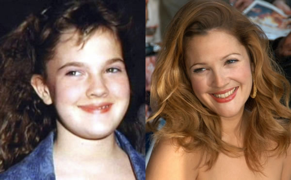 10 celebrities MUY atractivas... que desde luego No nacieron increíbles