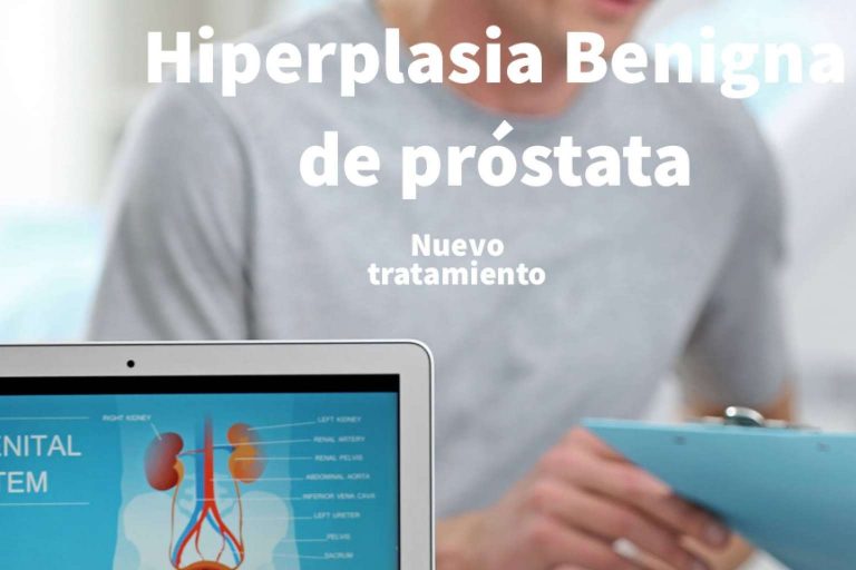 Hiperplasia benigna de próstata, qué es y cómo se puede tratar