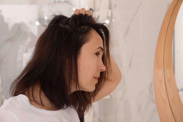 Las mujeres también pueden sufrir alopecia, por Clínica Femme