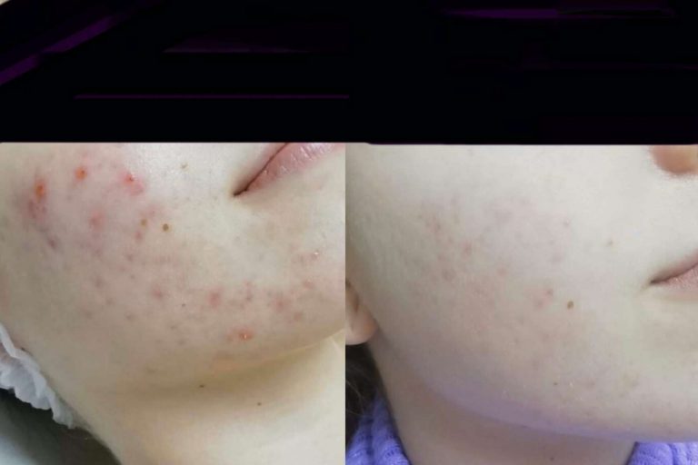 Las claves del centro Le Meilleur de Toi para conseguir resultados reales son los buenos hábitos y la constancia