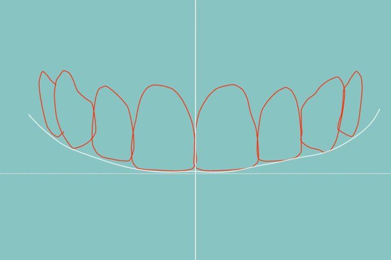 Clínica Dental Blay + Monzó dispone de tecnología de vanguardia para el diseño de sonrisa