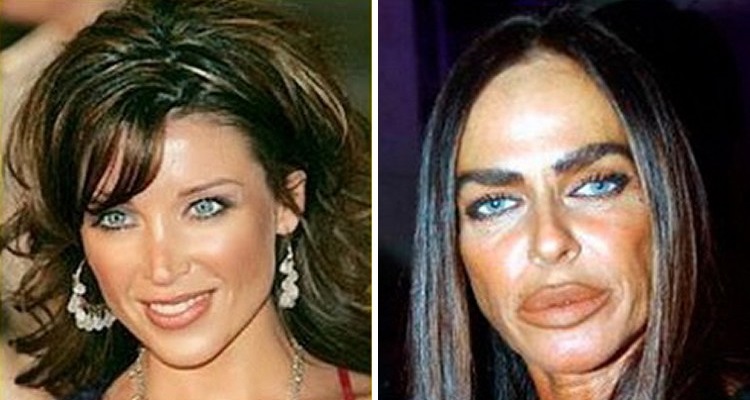 Pivones que se dejaron y ahora están horribles