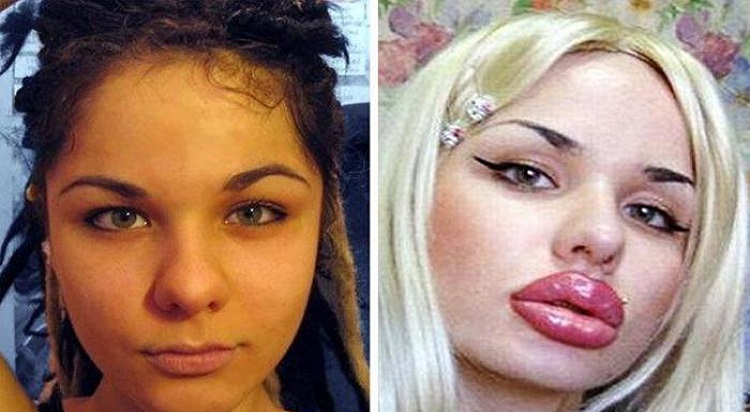 Pivones que se dejaron y ahora están horribles