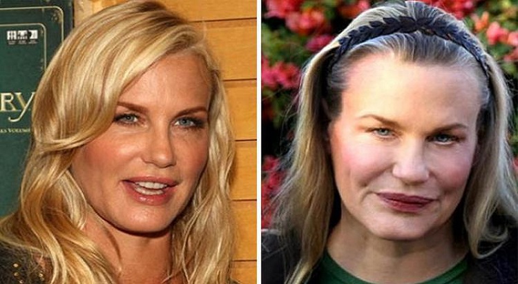 Pivones que se dejaron y ahora están horribles