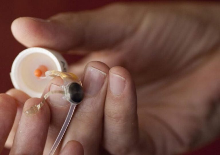 Los ojos biónicos de más de 350 personas quedan obsoletos al carecer de soporte