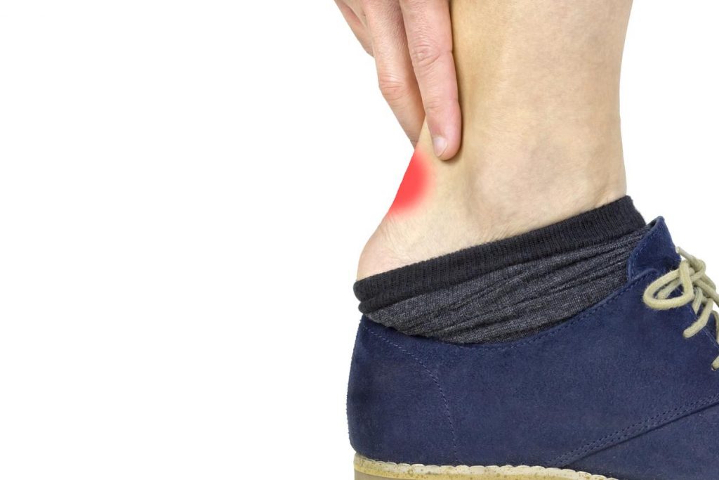 ¿Qué es una ampolla?