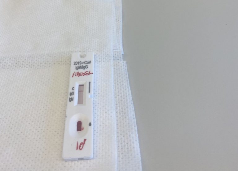 Canarias recibe 1.973 notificaciones de positivos Covid con la nueva plataforma de autotest