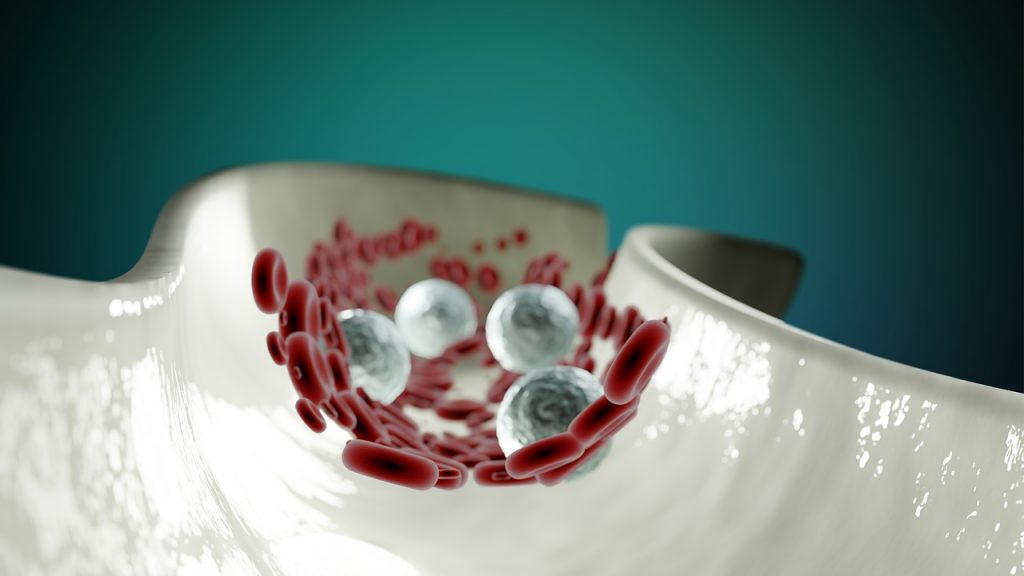 Señales que te avisan de que tienes el colesterol alto