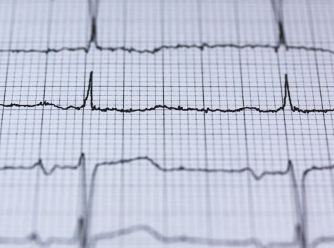 Cómo identificar una cardiopatía congénita Cómo identificar una cardiopatía congénita