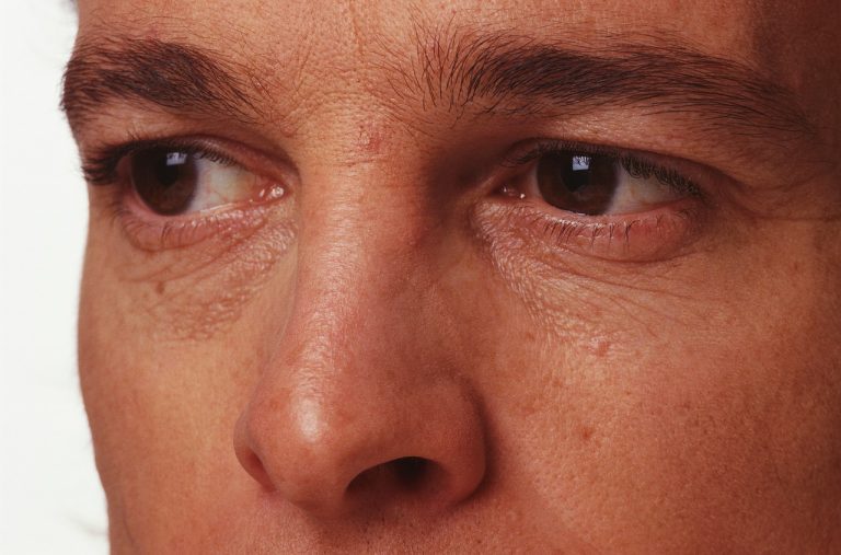 La rinoplastia en hombres es la tercera operación estética más demandada