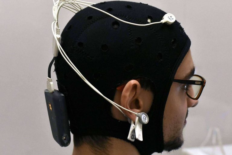 Los tratamientos de neuromodulación ayudan a la recuperación tras sufrir un ictus