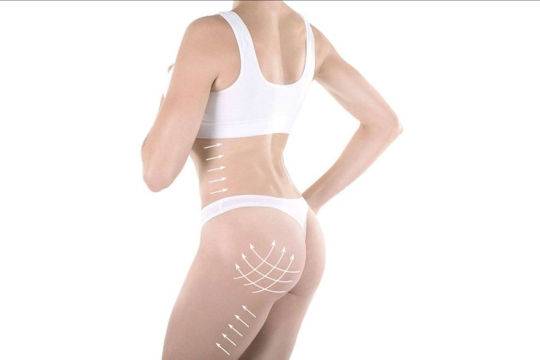 Brazilian Butt Lift, la última tendencia en aumento de glúteos en Clínica Tarrazo