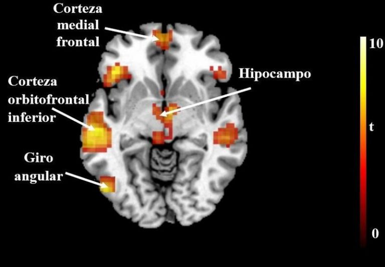 Científicos analizan cómo responde el cerebro ante mensajes que promueven un consumo saludable