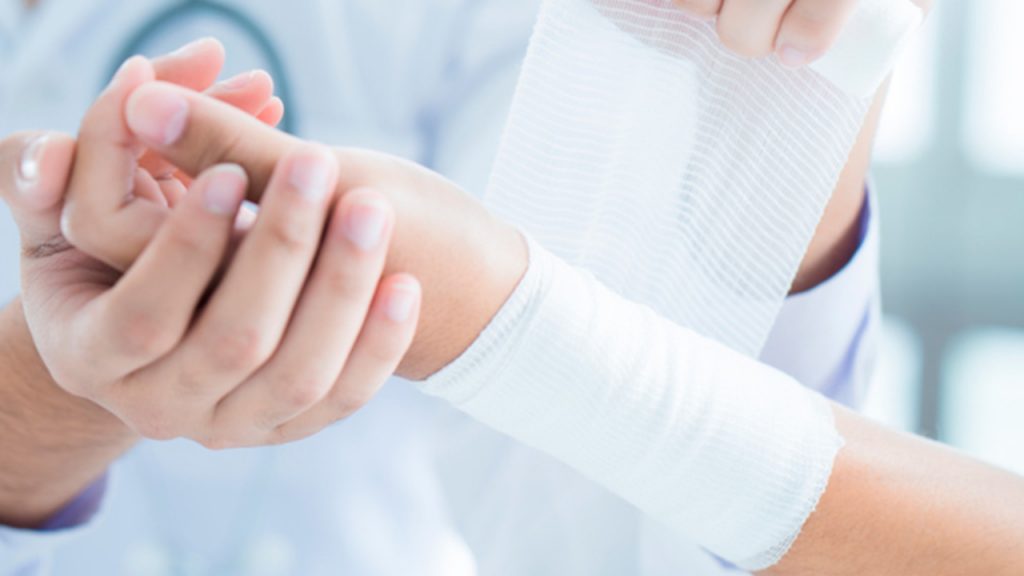 Esto es lo que debes hacer si te quemas con agua hirviendo 8