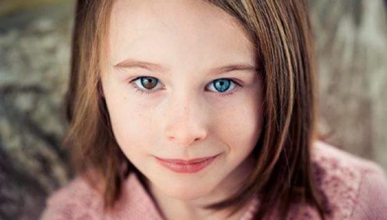 Famosos que no sabías que tienen un ojo de cada color