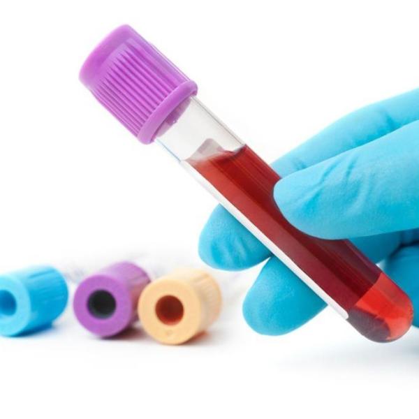 ¿Hay que realizar algún tipo de preparación para que se realice un examen de GGTP?