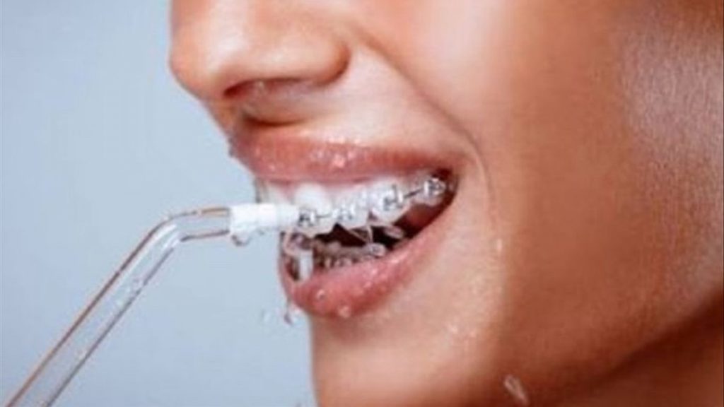 ¿Qué es un diente?