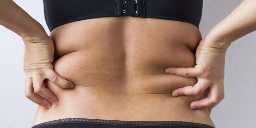 ¿En qué consiste una lipoescultura?