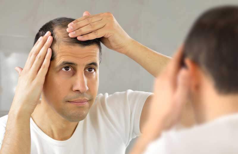 Qué hacer si se te cae mucho el pelo