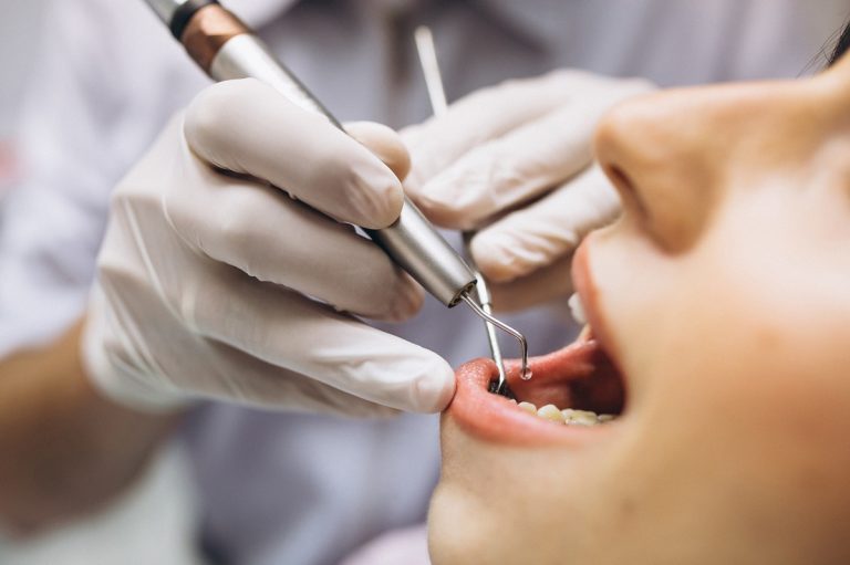 Los efectos secundarios que puedes sufrir tras una anestesia dental