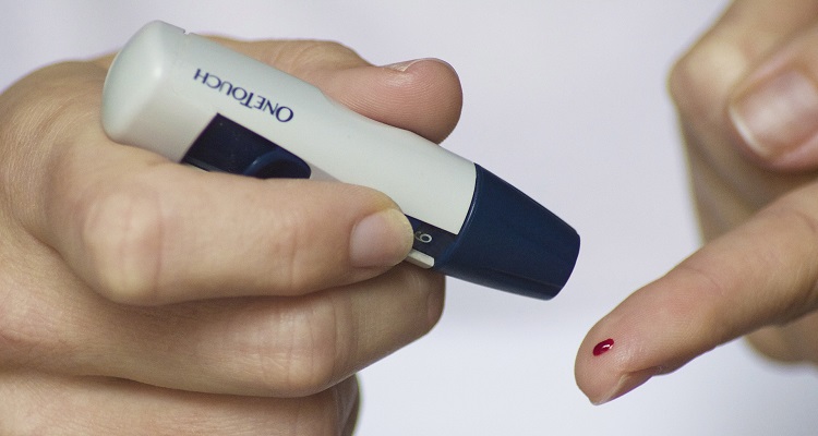 Un estudio apunta que la acupuntura podría ayudar a prevenir la diabetes
