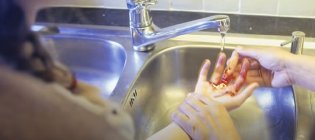 Cómo desinfectar una herida