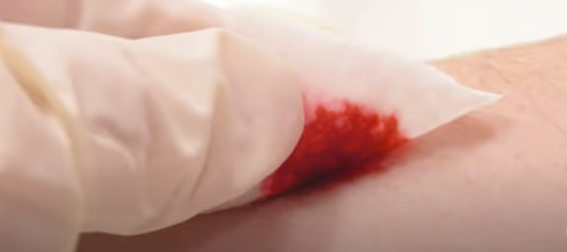 Cómo desinfectar una herida