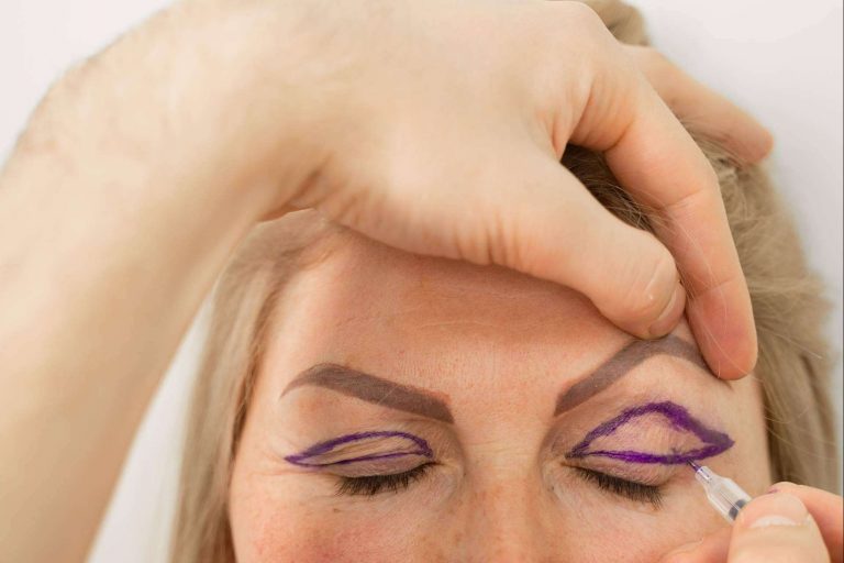 La blefaroplastia sin cirugía llega de la mano del plasma láser de Alluring Clinic