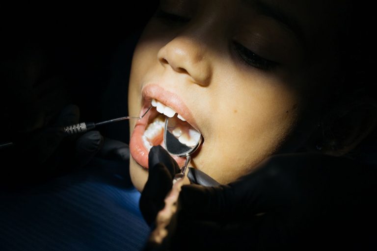 Cómo eliminar el sarro de los dientes sin ir a un dentista