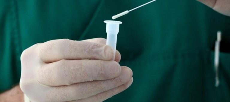 Los anticuerpos contra SARS-CoV-2 son indetectables en casi el 50% de infectados tras 7 meses del contagio