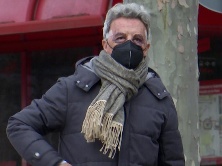 La impactante imagen de Ortega Cano con los ojos morados tras un retoque estético