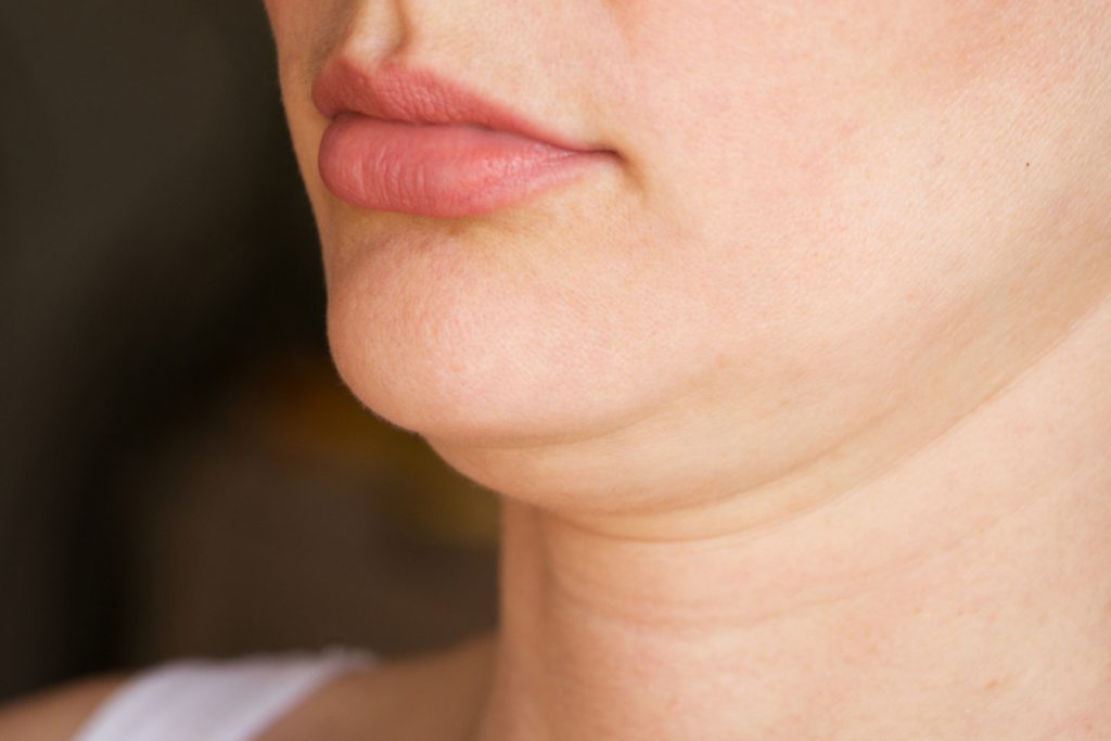 Recurrir a tratamientos estéticos