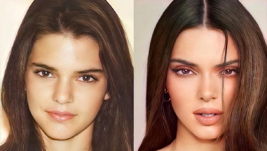 El antes y el después de los hermanos famosos de Hollywood 81 Kylie y Kendall Jenner