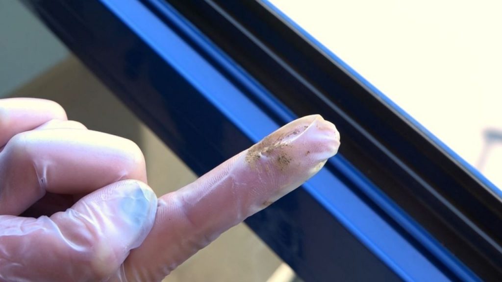 Lo mejor es tomar medidas preventivas